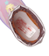 BB AP26U　13-15KIDSﾗﾊﾞｰﾌﾞｰﾂ　ﾋﾟﾝｸ　703217-0001