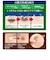 【当商品送料無料】黒ずみ しみ取り 通販 クロパックン プレミアム 30ｇ シミケア シミ取り 簡単ケア 美容液 スキンケア 吸着パック 化粧品