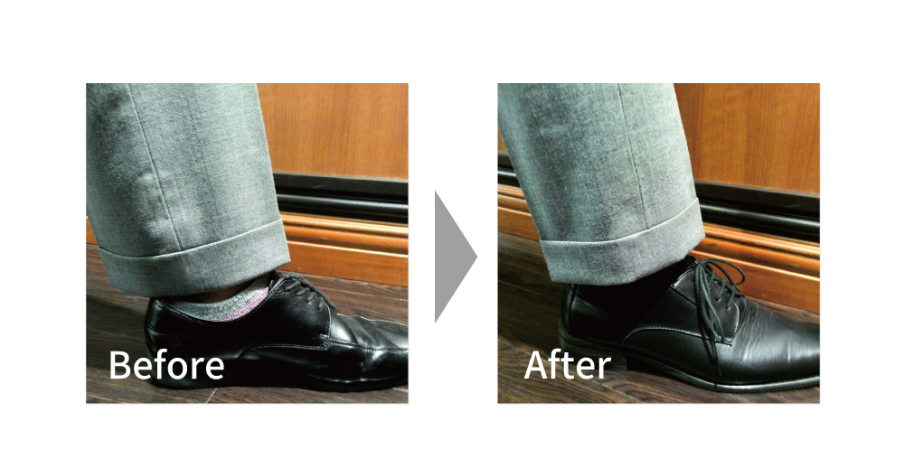 The hem width has been narrowed, and the double-breasted design has been restored.